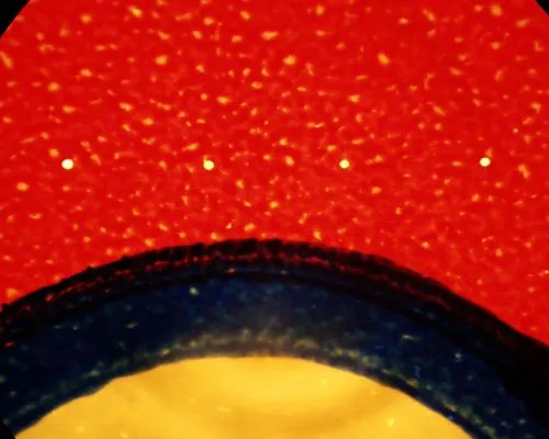 Laser Mikroperforation